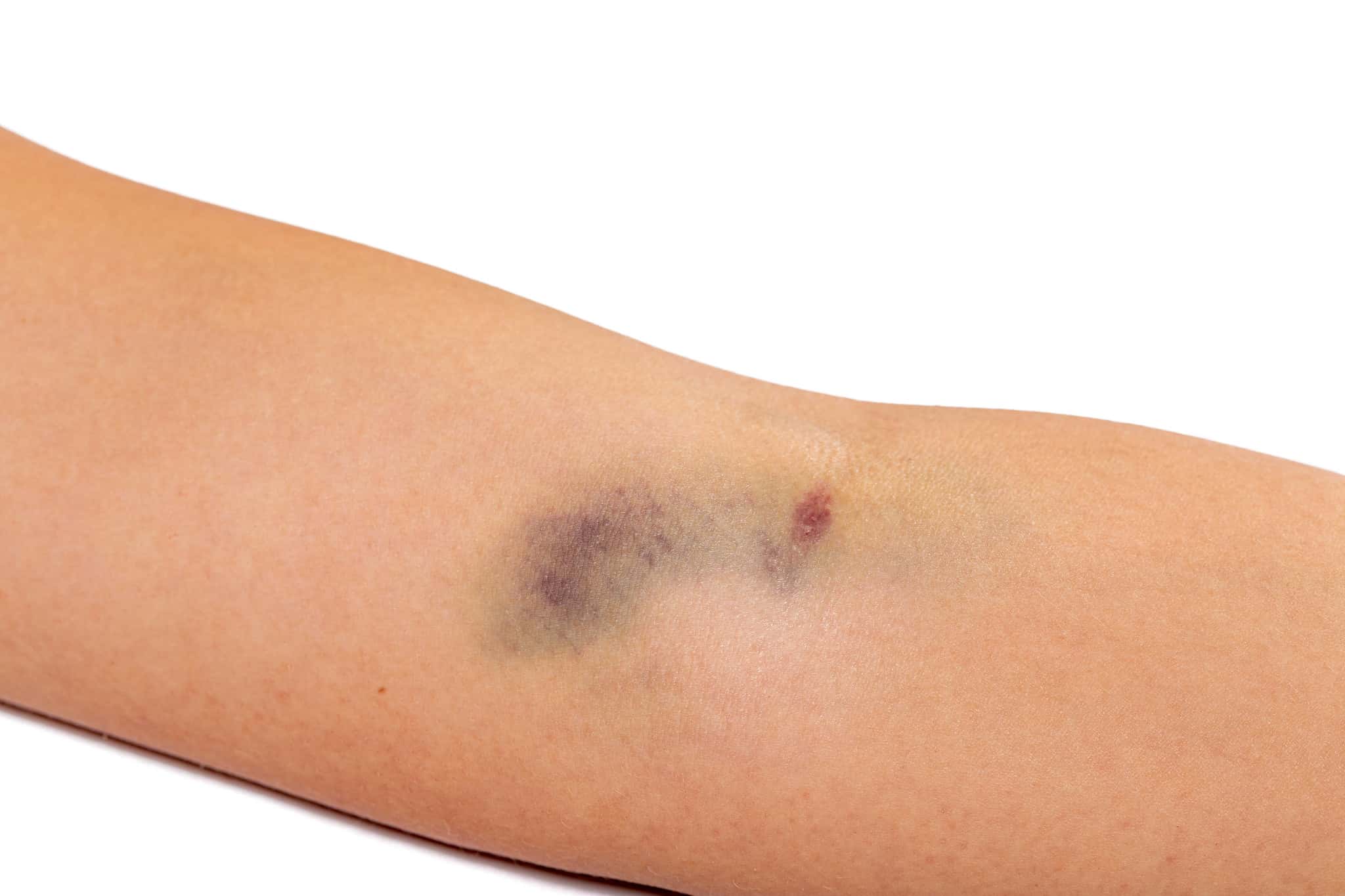 Miraculous Survival Stories