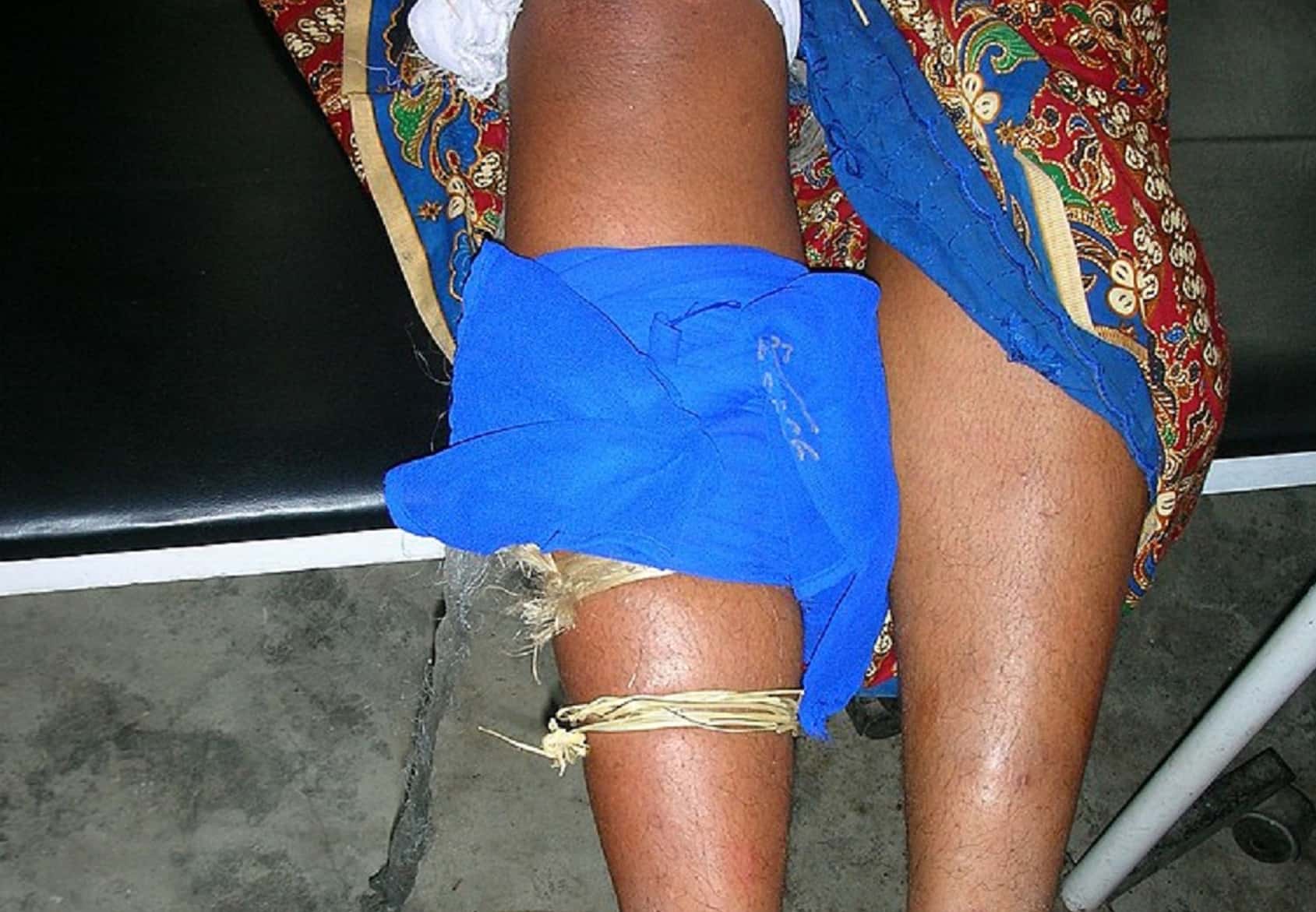 Miraculous Survival Stories