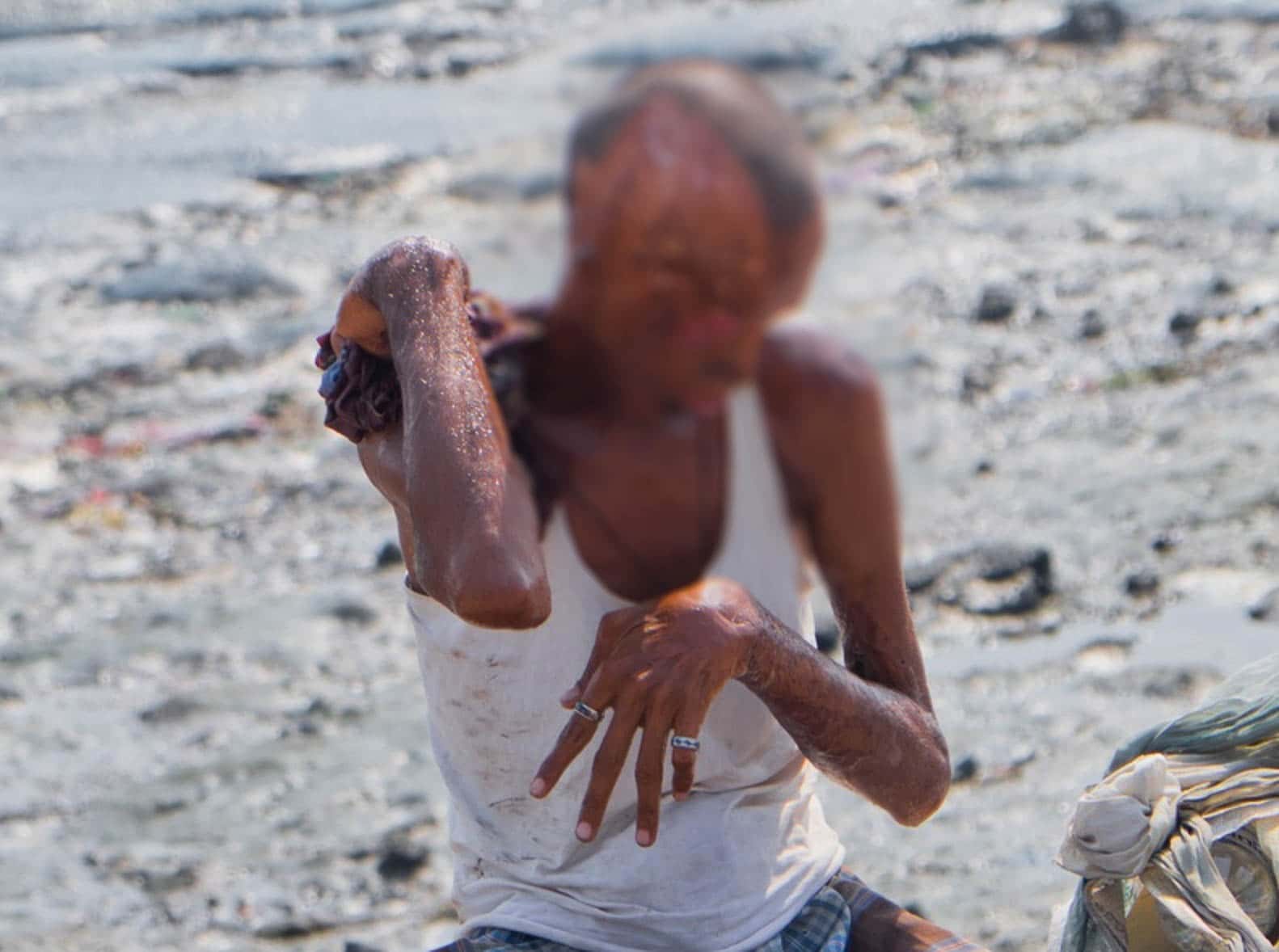 Miraculous Survival Stories