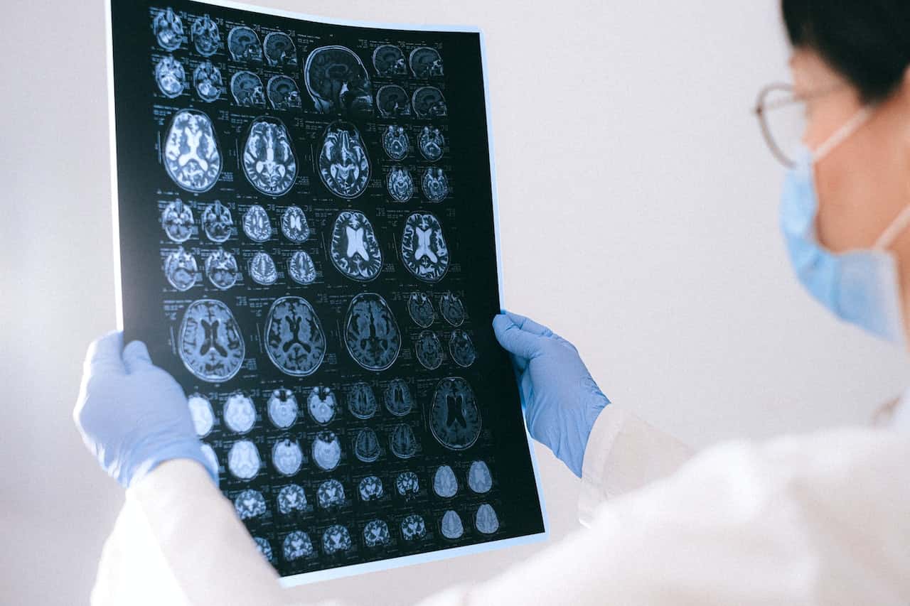 a doctor holding an MRI result of the brain