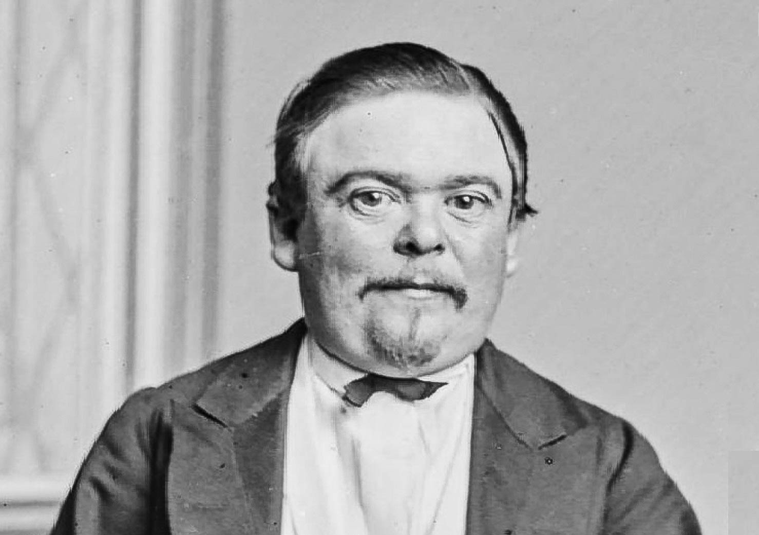 Charles Sherwood Stratton Facts