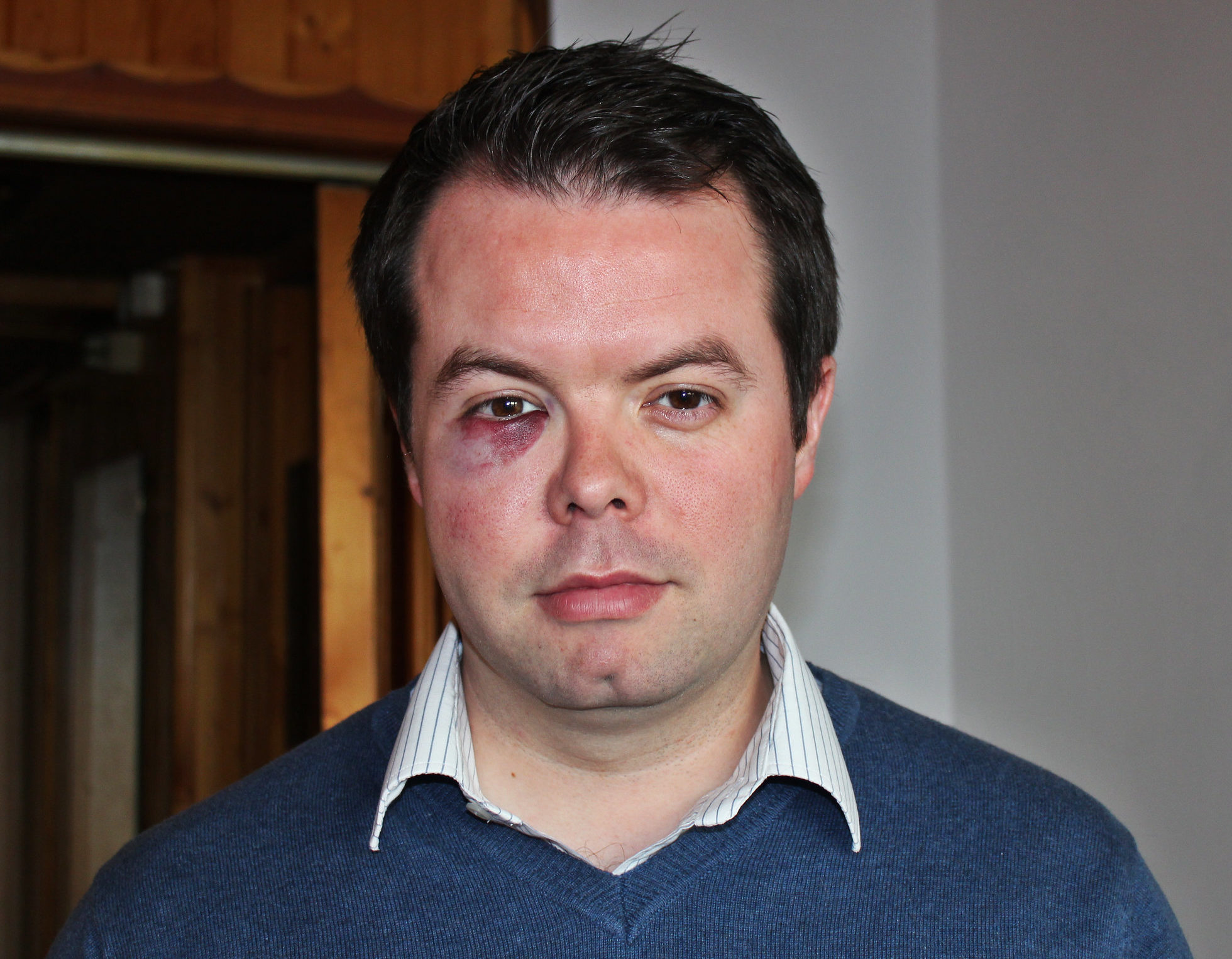 Hilarious Anesthesia Moments