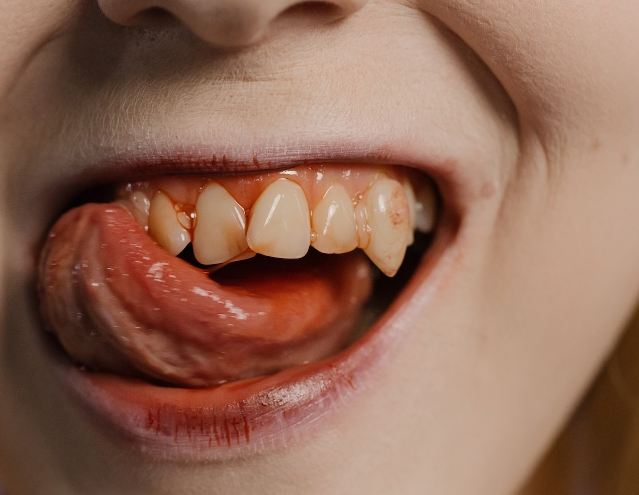 Psych Ward Nurses Tell All