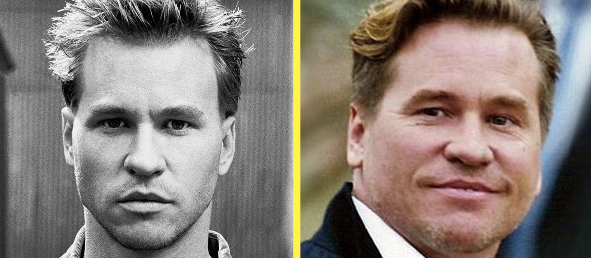 valkilmer