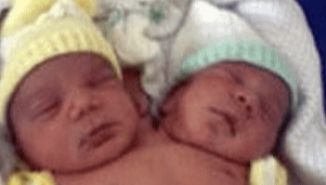 30 Interesting Things About Famous Conjoined Twins Abby And Brittany Hensel