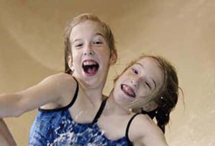 30 Interesting Things About Famous Conjoined Twins Abby And Brittany Hensel