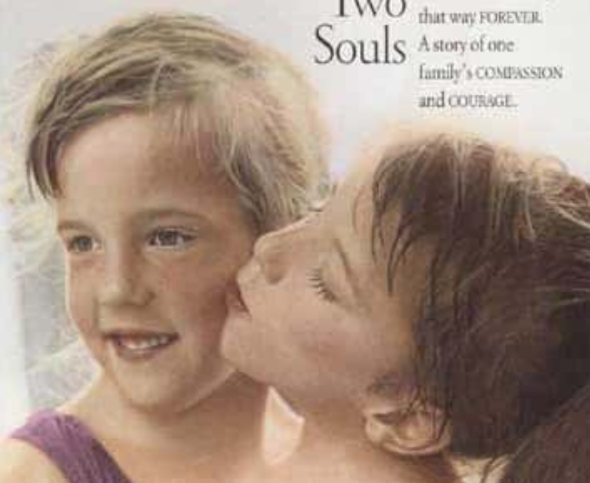 30 Interesting Things About Famous Conjoined Twins Abby And Brittany Hensel