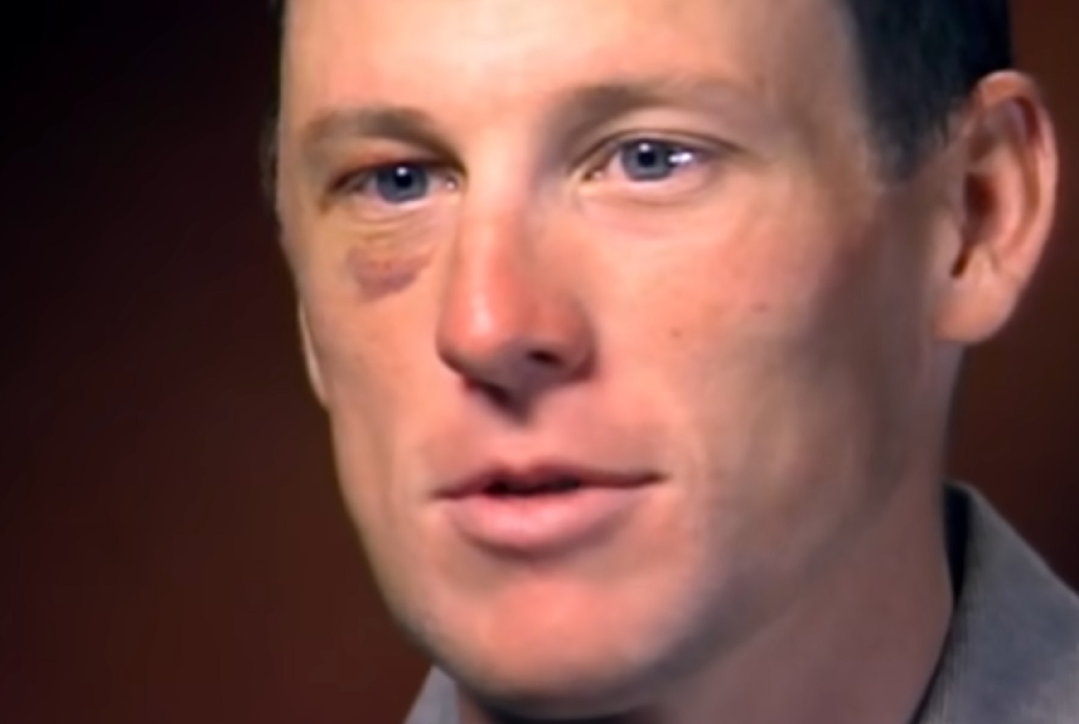 Screenshot: Lance Armstrong looking at front with bruised eye - from Stop At Nothing- The Lance Armstrong Story (2014)