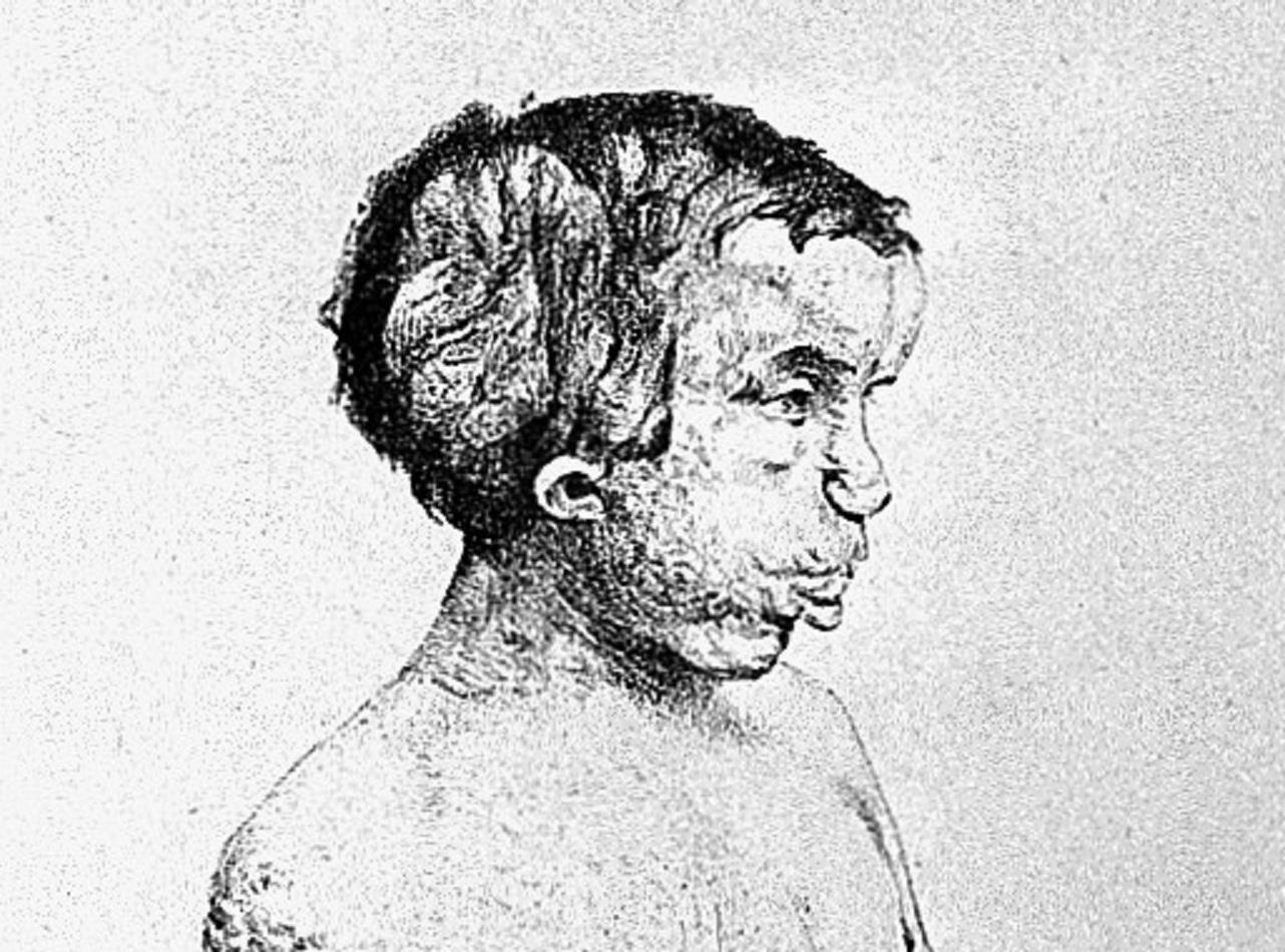 Image of Elephant Man looking at side.