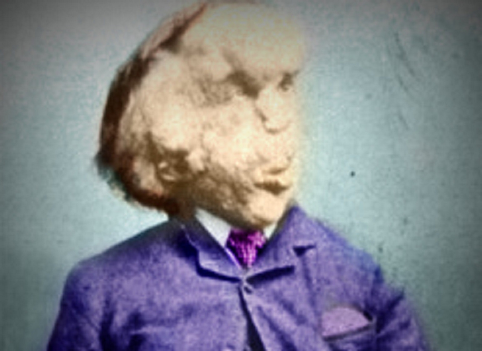 Color picture of Joseph Carey Merrick looking at side.