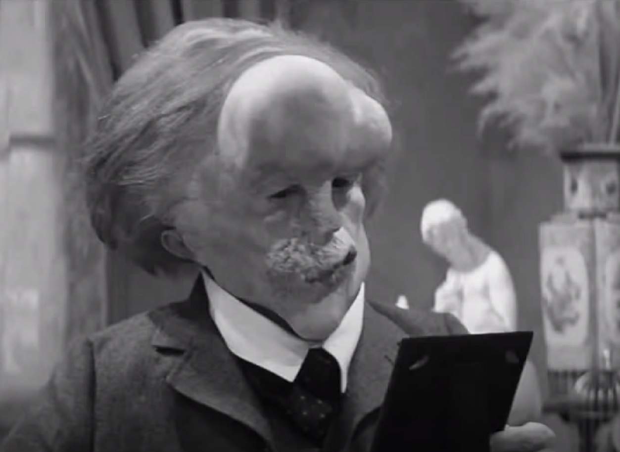 B&W Screenshot of Joseph Merrick (John Hurt) looking at side wearing a suit - from Elephant Man (1980)