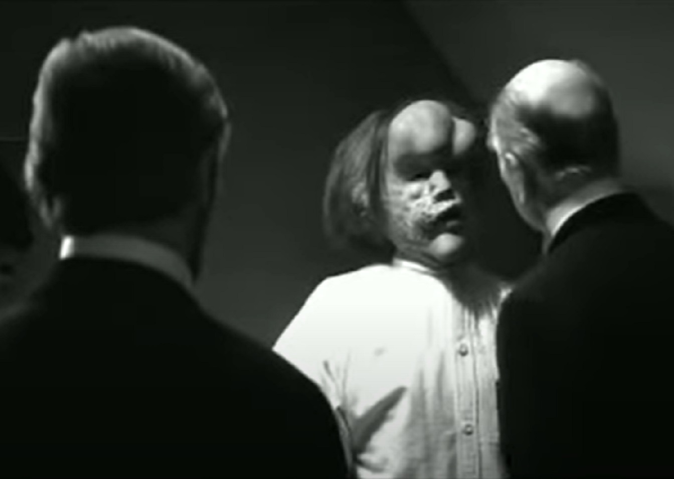 B&W Screenshot of Joseph Merrick (John Hurt) talking with doctors - from Elephant Man (1980)