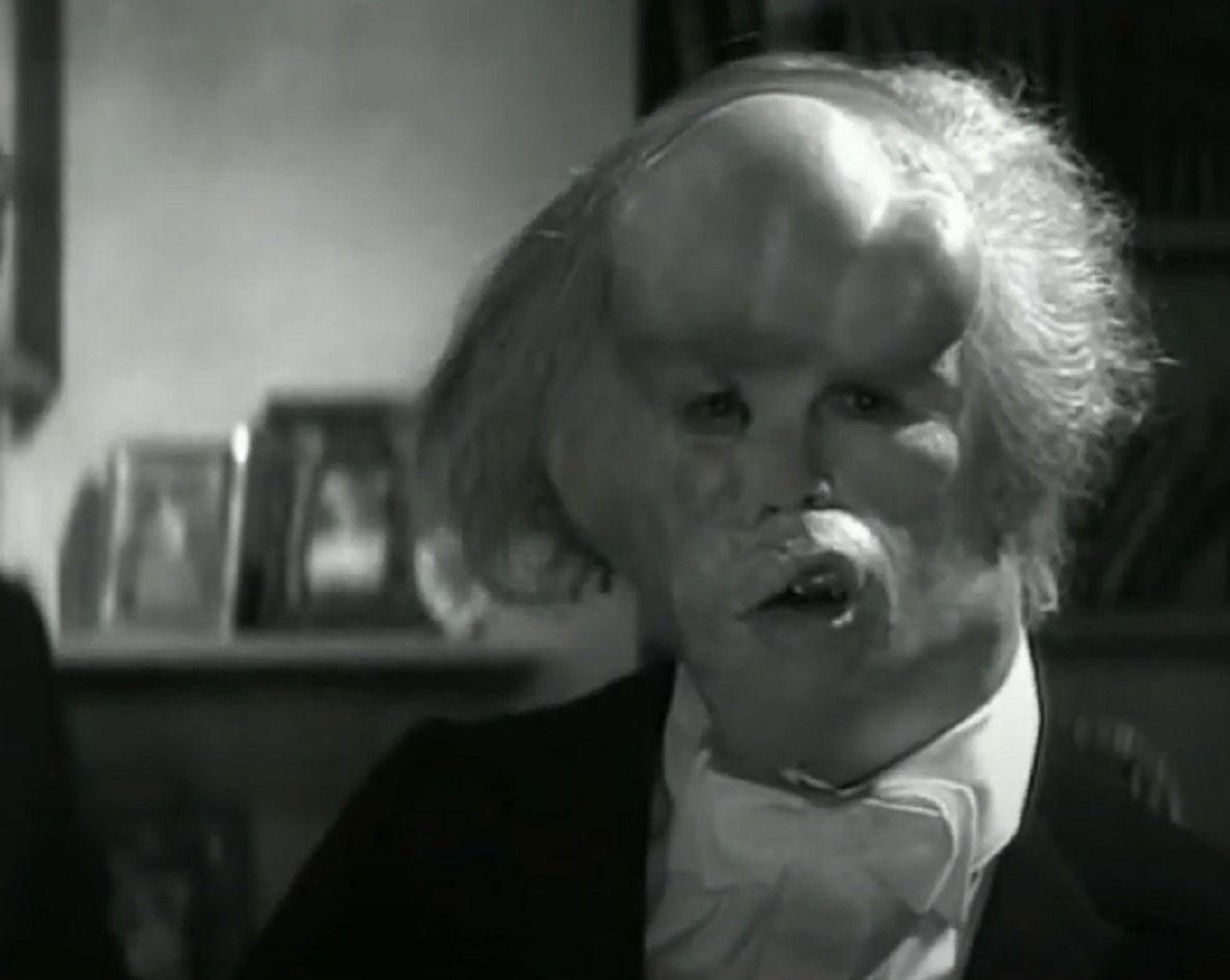 B&W Screenshot of Joseph Merrick (John Hurt) wearing suit and looking at camera - from Elephant Man (1980)