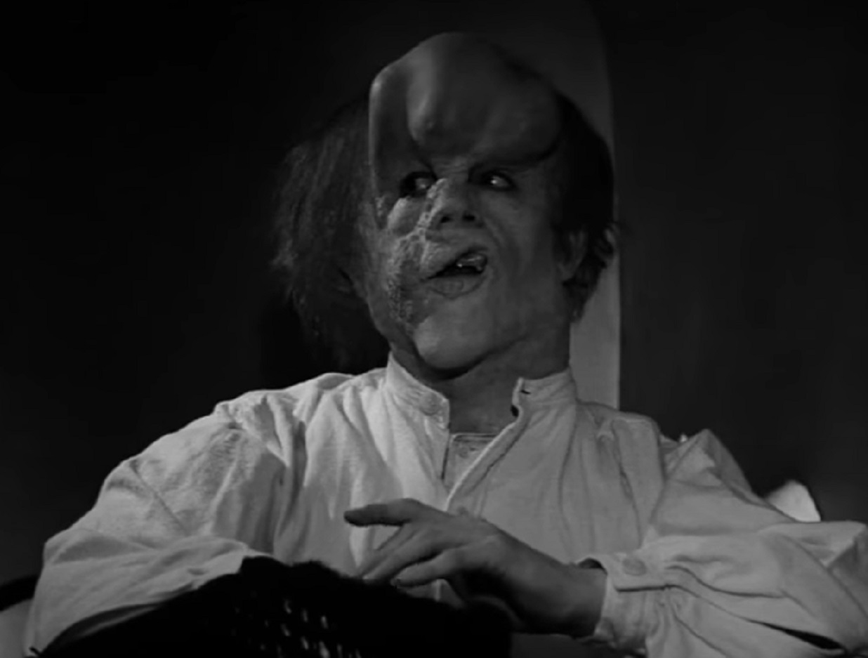 B&W Screenshot of Joseph Merrick (John Hurt) in white shirt is looking at side - from Elephant Man (1980)