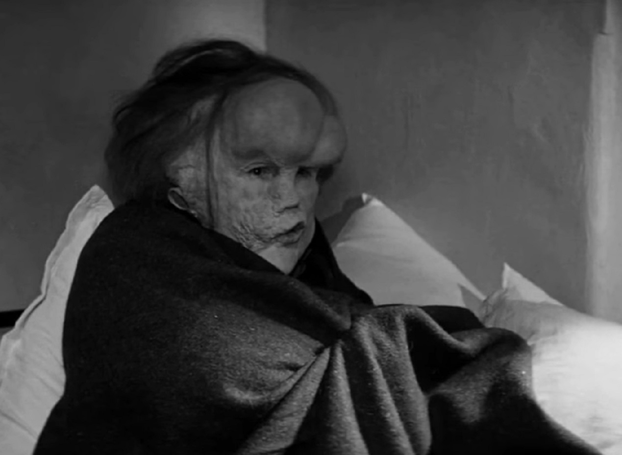 B&W Screenshot of Joseph Merrick (John Hurt) seating in bed with scared face - from Elephant Man (1980)