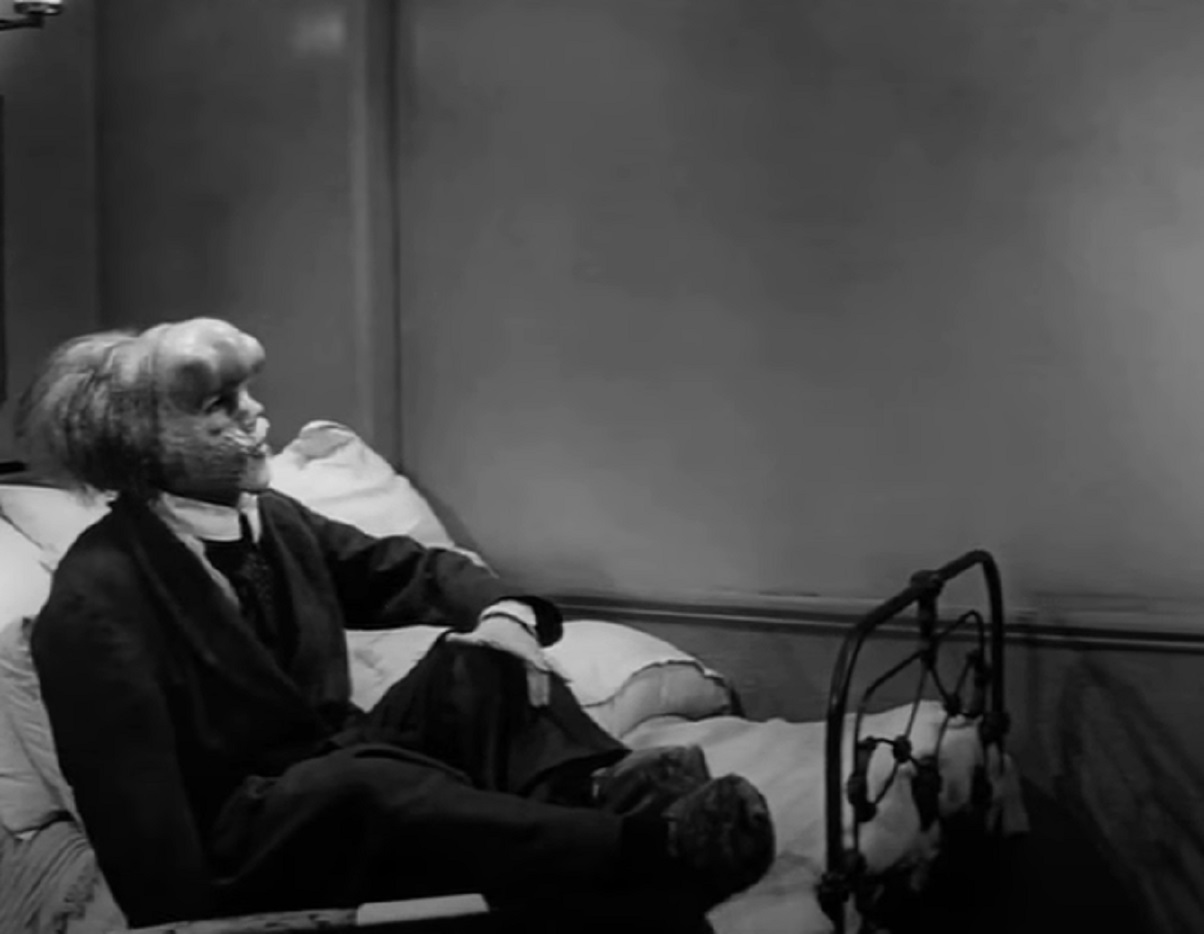 B&W Screenshot of Joseph Merrick (John Hurt) seating on the bed - from Elephant Man (1980)