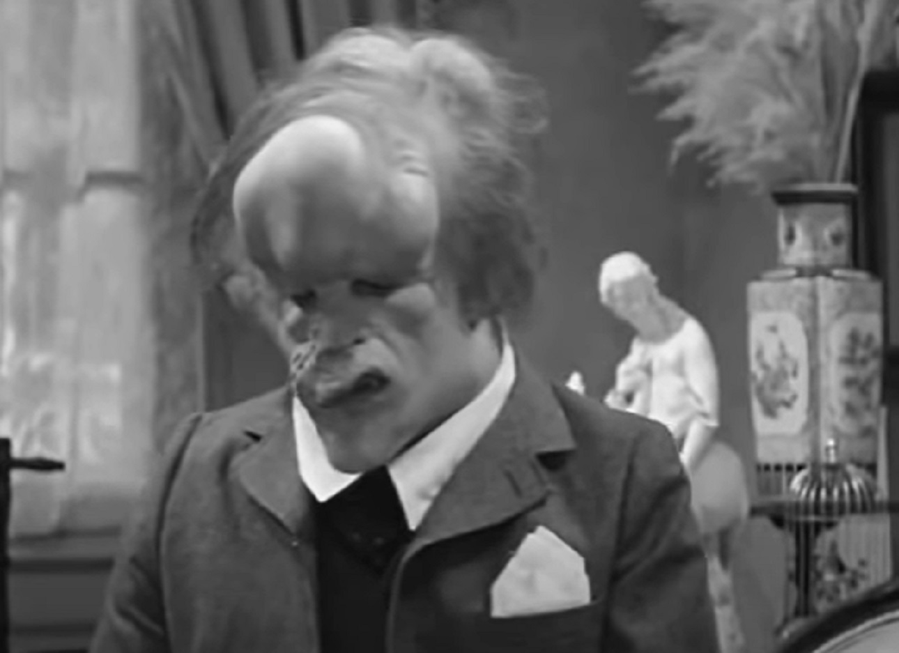 B&W Screenshot of Joseph Merrick (John Hurt) looking down wearing suit - from Elephant Man (1980)