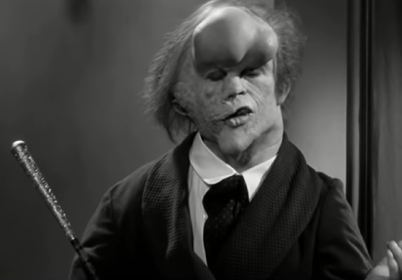 B&W Screenshot of Joseph Merrick (John Hurt) wearing suit and holding a cane is looking down - from Elephant Man (1980)