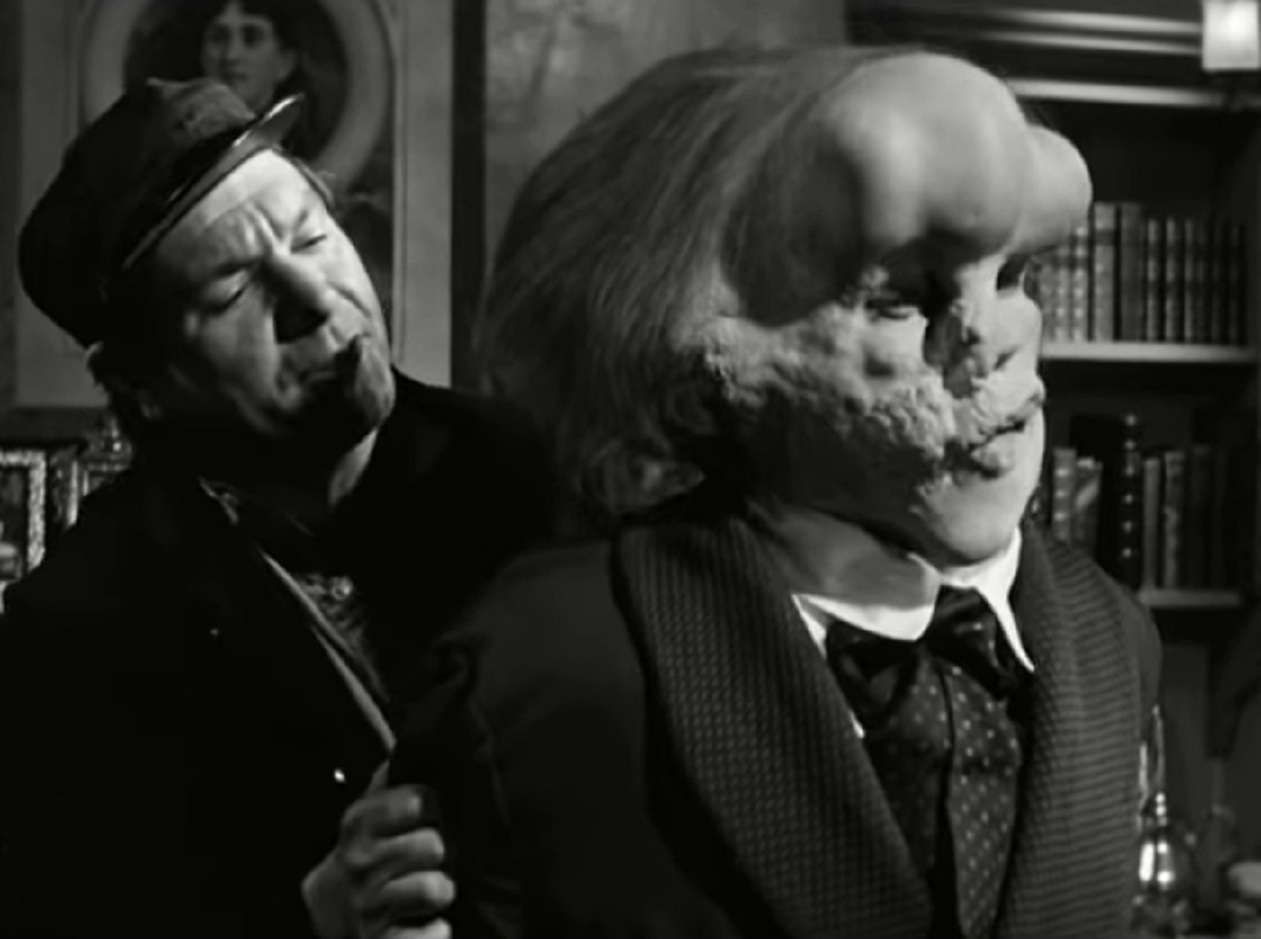 B&W Screenshot of Joseph Merrick (John Hurt) looking at front - from Elephant Man (1980)