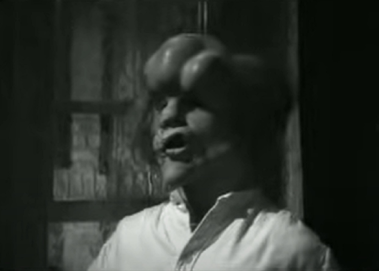 B&W Screenshot of Joseph Merrick (John Hurt) looking at side in white shirt - from Elephant Man (1980)