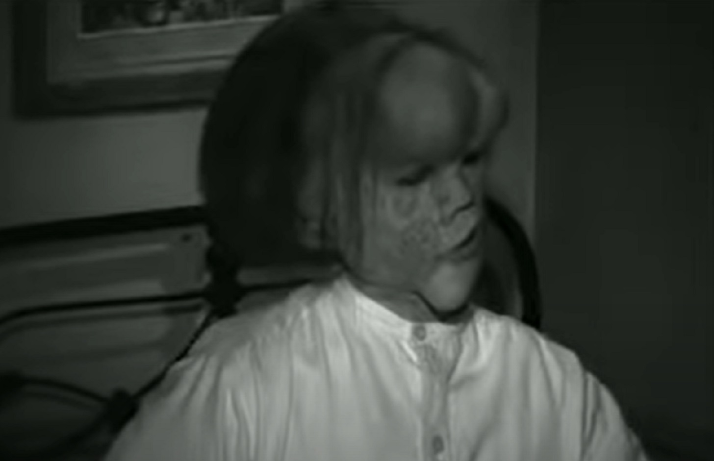 B&W Screenshot of Joseph Merrick (John Hurt) looking at side - from Elephant Man (1980)