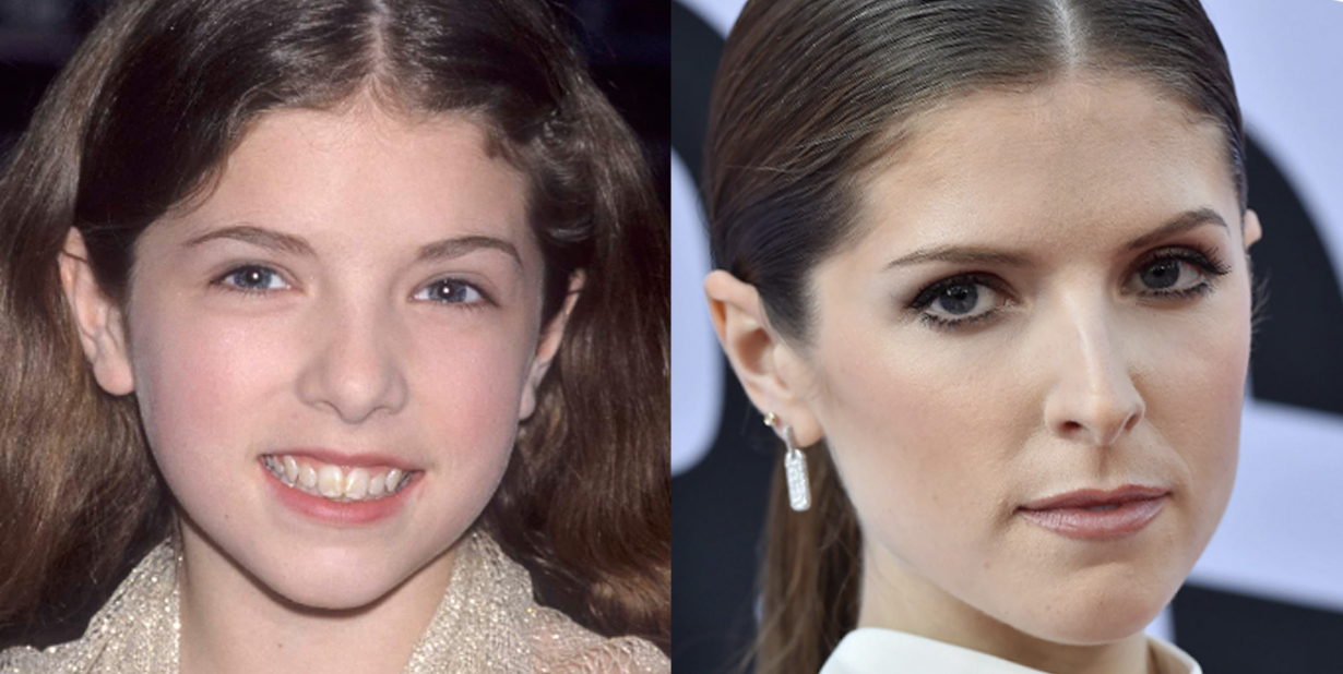 Anna Kendrick Split Gallery