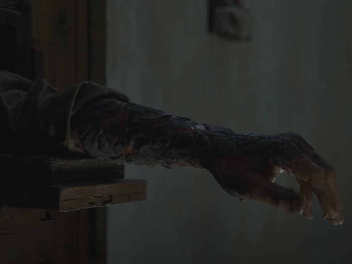 Screenshot of Jorah Mormont's hand with greyscale - from Game of Thrones (2011-19)