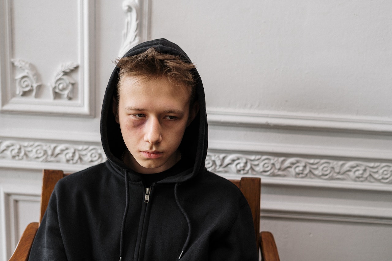 Kid with black hoodie is seating sad on chair with bruised eye.