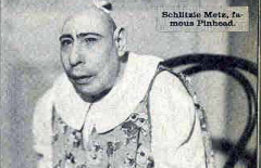 Schlitzie