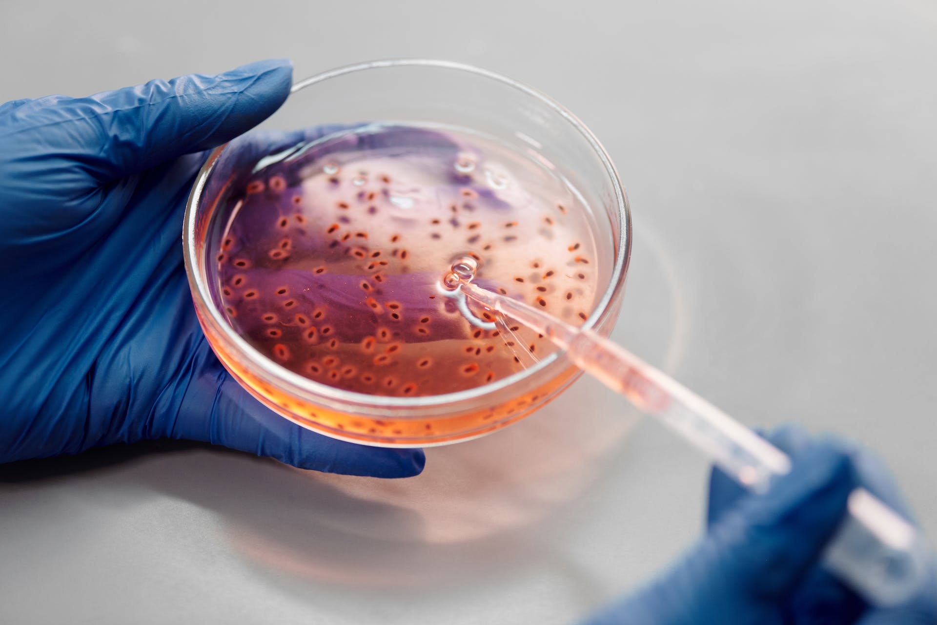 Close-up photo of a person with blue medicinal gloves using a pipette and a petri dish