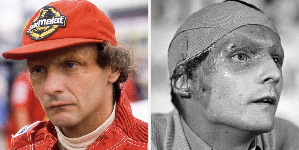 niki lauda