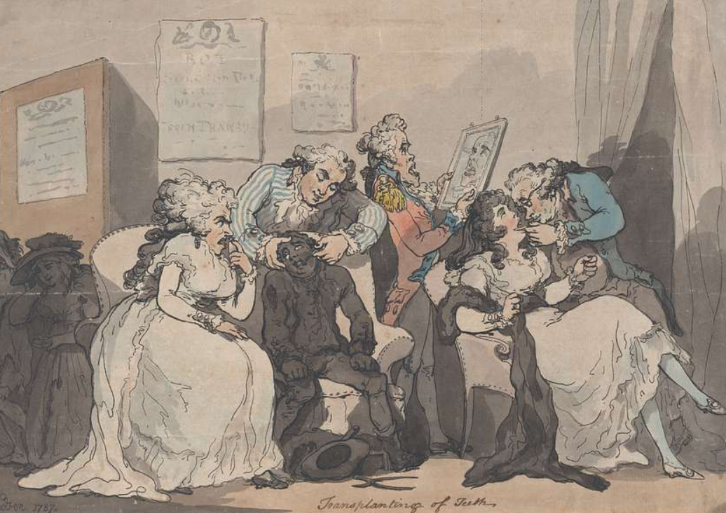Transplanting of Teeth, Thomas Rowlandson. Georgian era 1714 - 1737