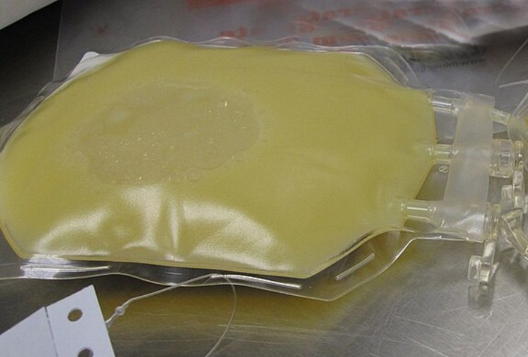 A bag of fresh frozen plasma