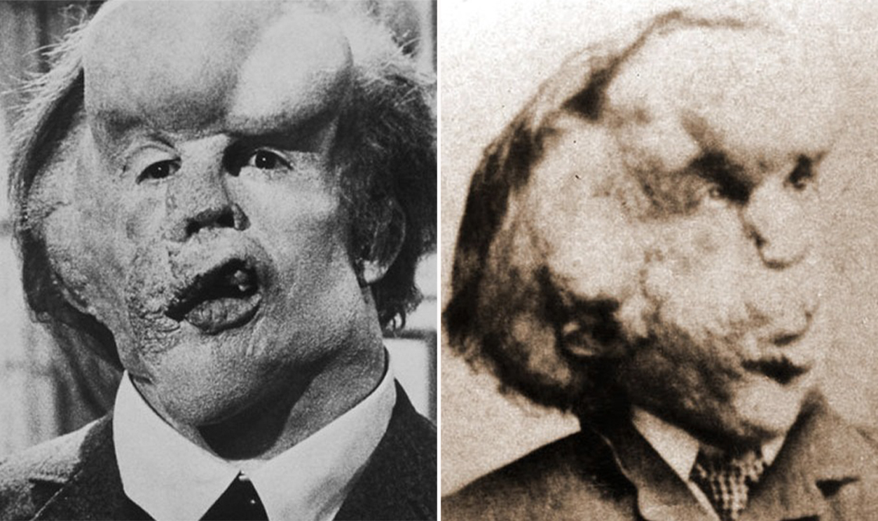 joseph merrick, elephant man
