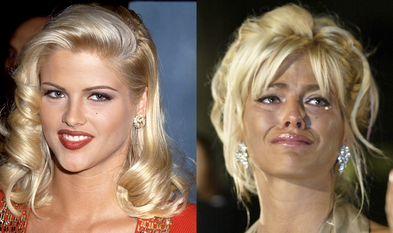 Anna Icole Smith Msn Split3