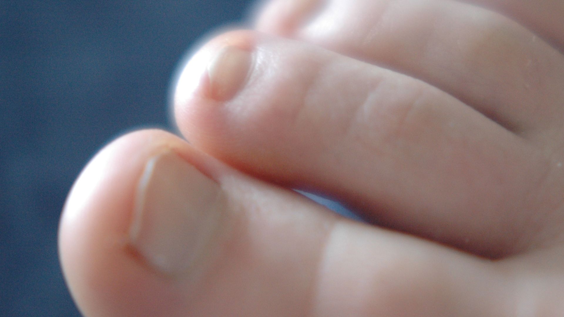 File:Toes.jpg