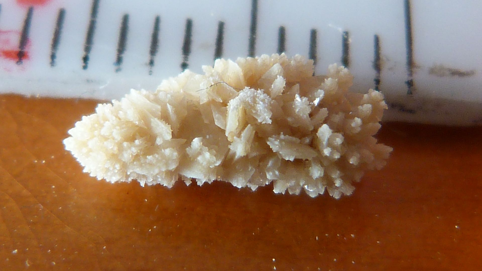 File:Kidney stone 01.JPG