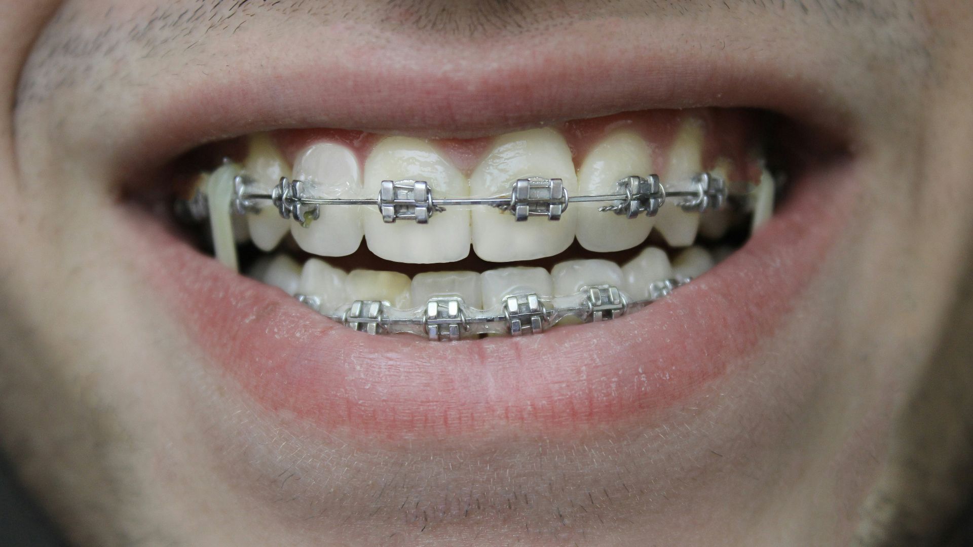 close-up of a person's mouth