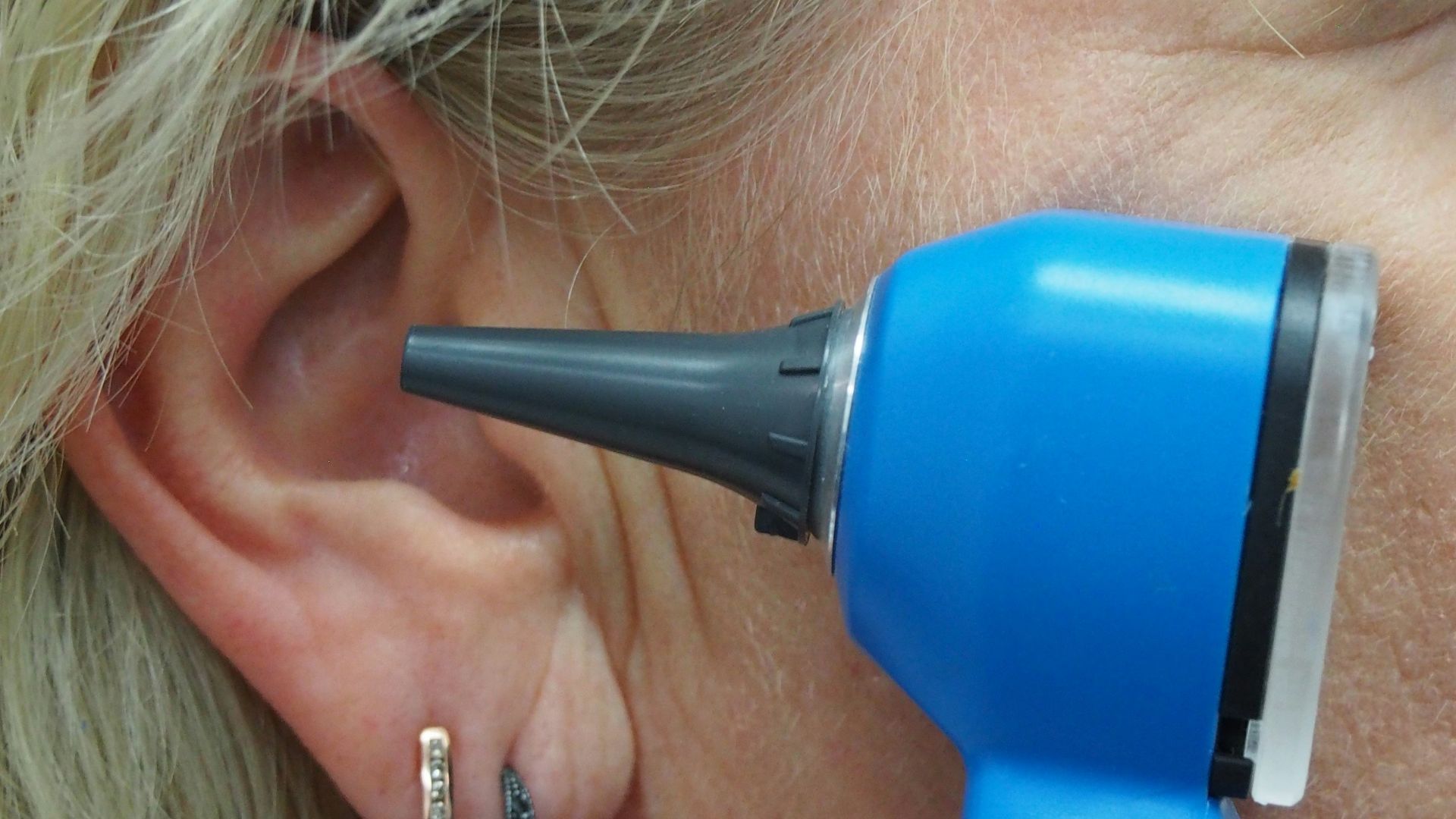 A doctor is using an otoscope to check ear.