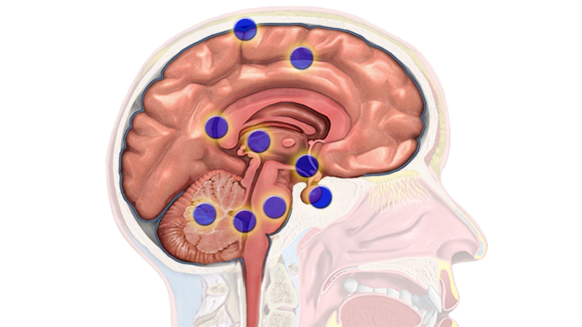 File:Brain Cancer Regions.png