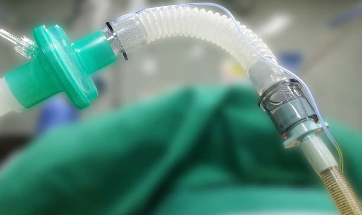 Endotracheal Tube, Shutterstock, 741883582