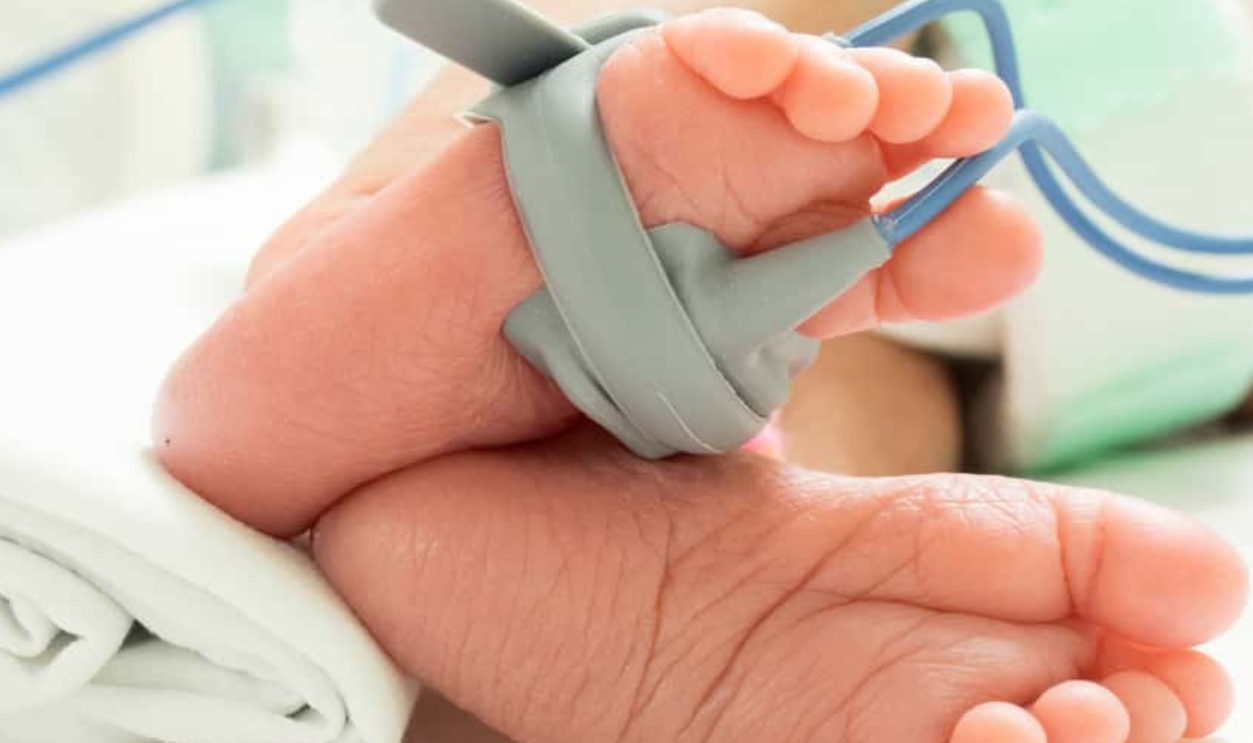 Pulse Oxymeter On Baby Foot, Shutterstock, 397786159
