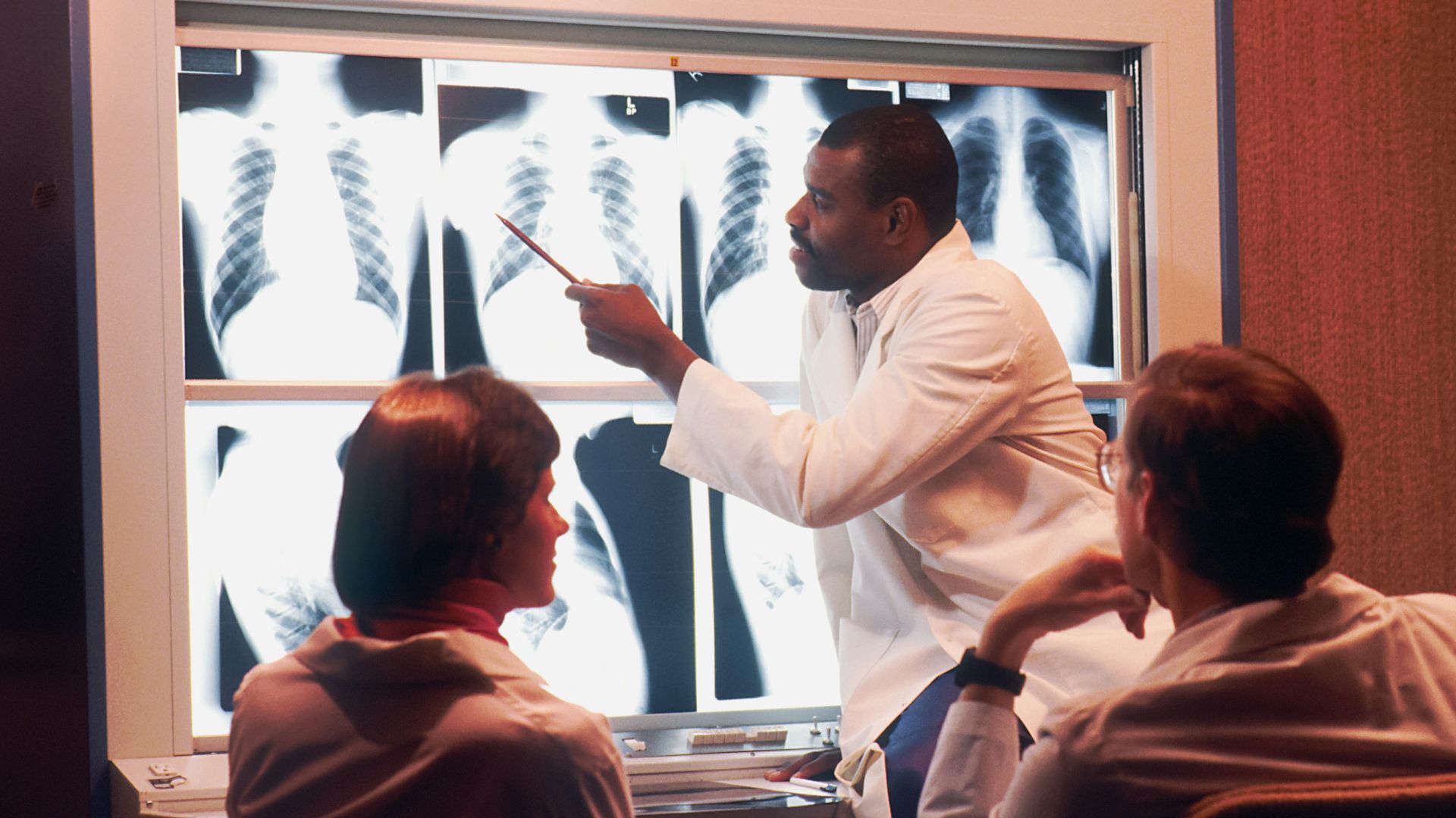 a man in a white lab coat pointing to an x - ray