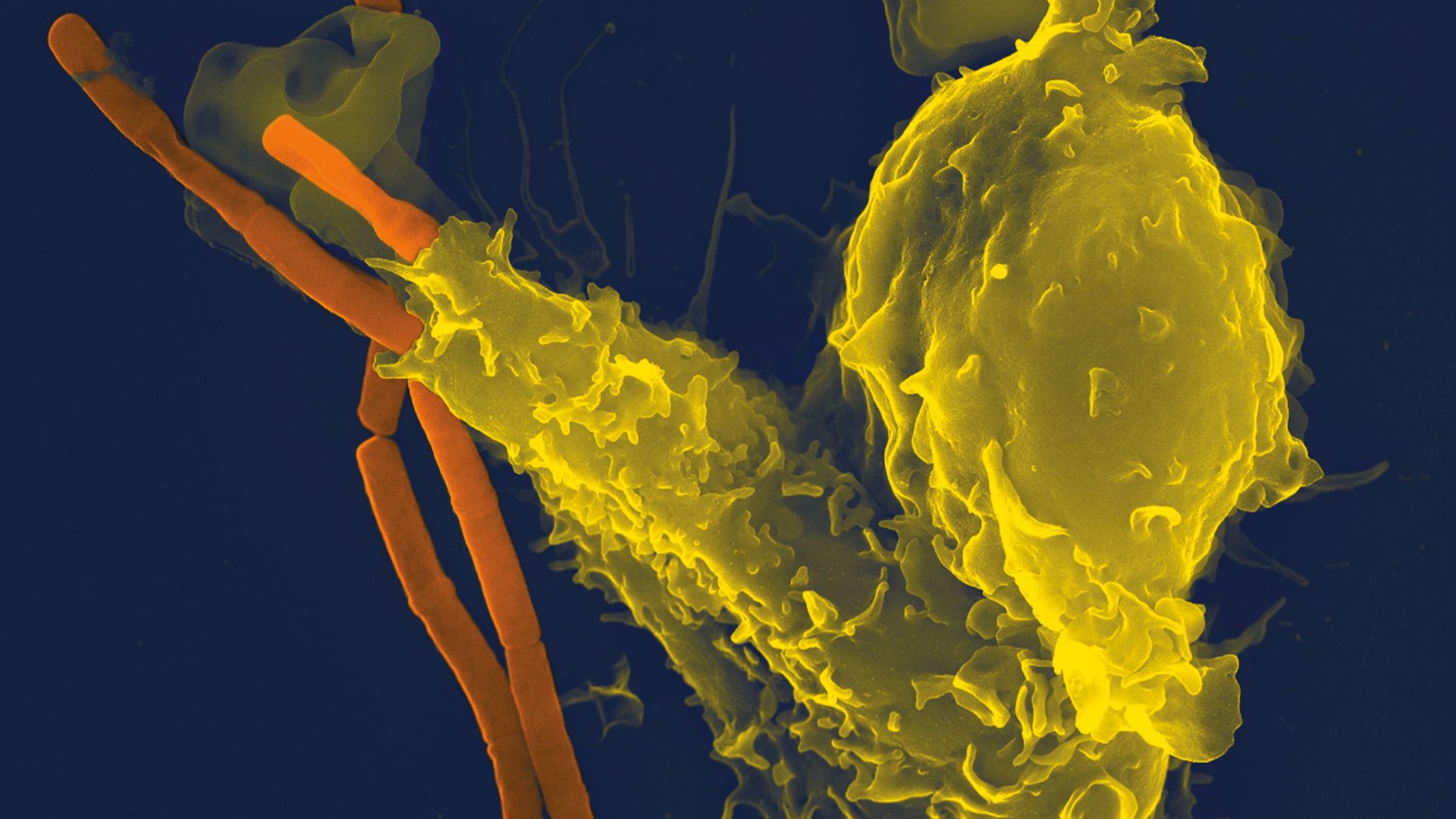 File:Neutrophil with anthrax copy.jpg