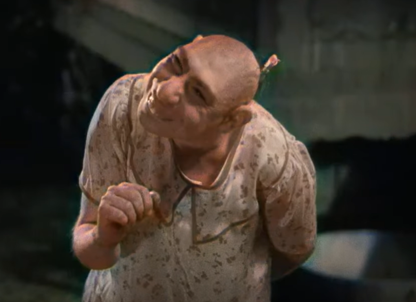 Screenshot of Schlitzie from - Freaks (1932)