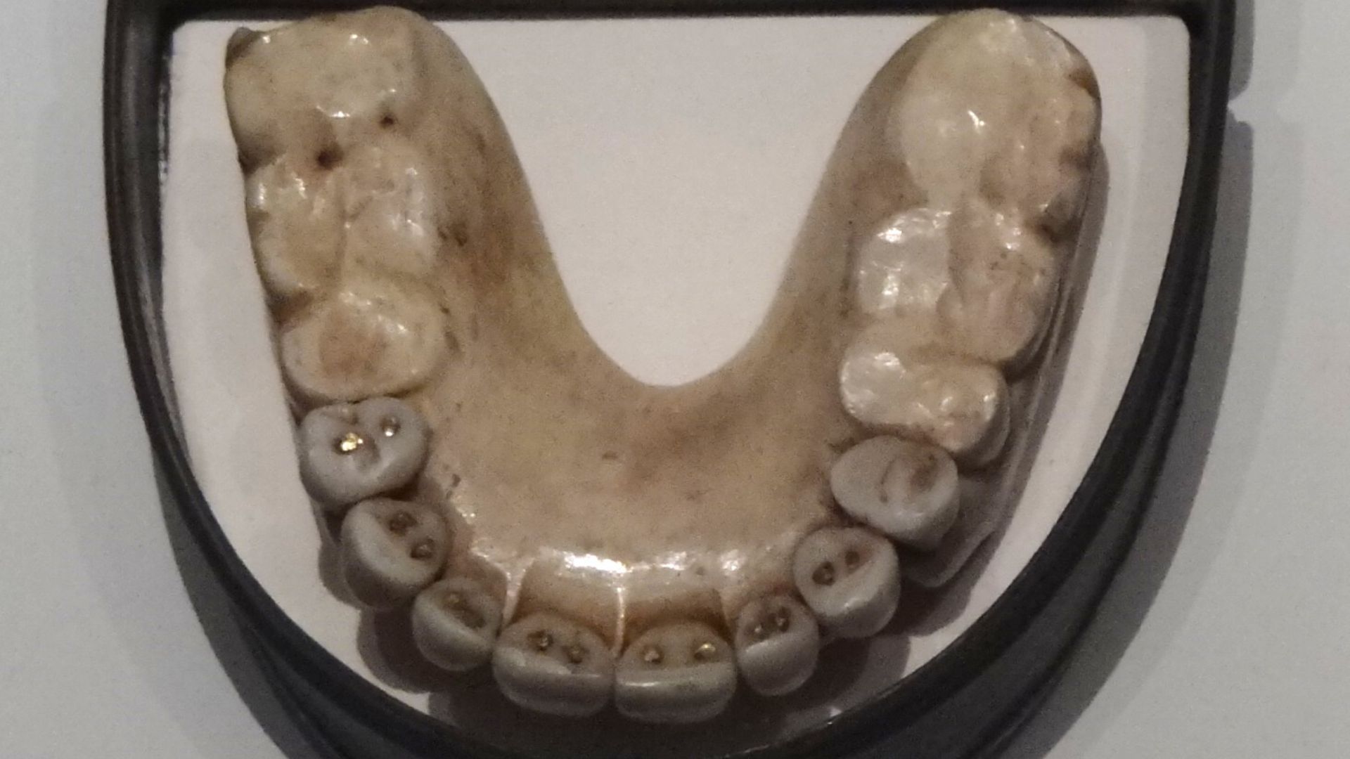 File:Dentures with Waterloo Teeth - Military Museum - Dresden - Germany crop.jpg