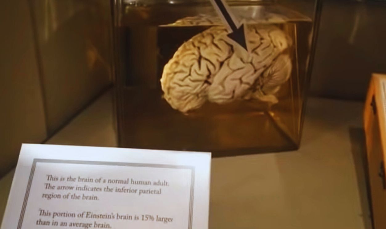 Albert Einstein’s Preserved Brain Samples