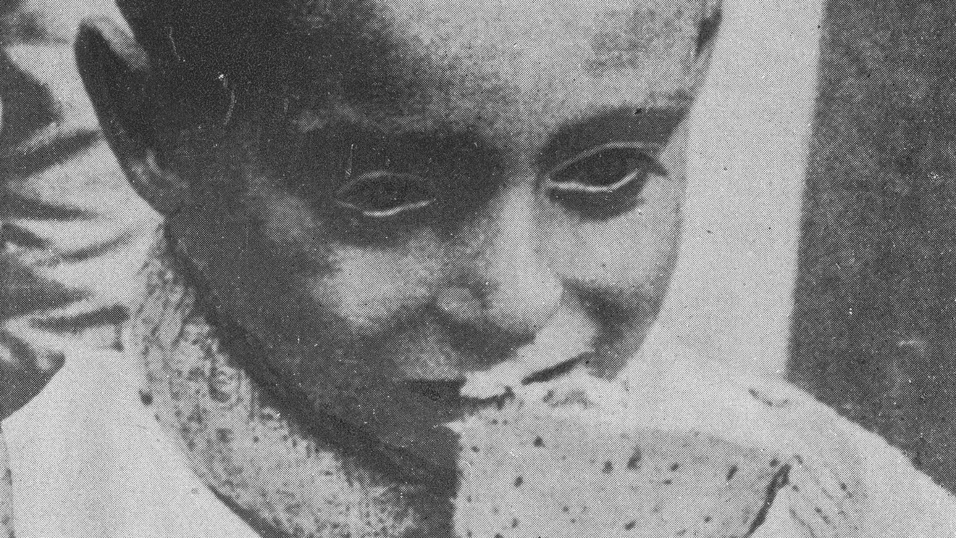 File:Hunger Disease Clinical Research in Famine Performed in the Warsaw Ghetto in 1942 06.jpg