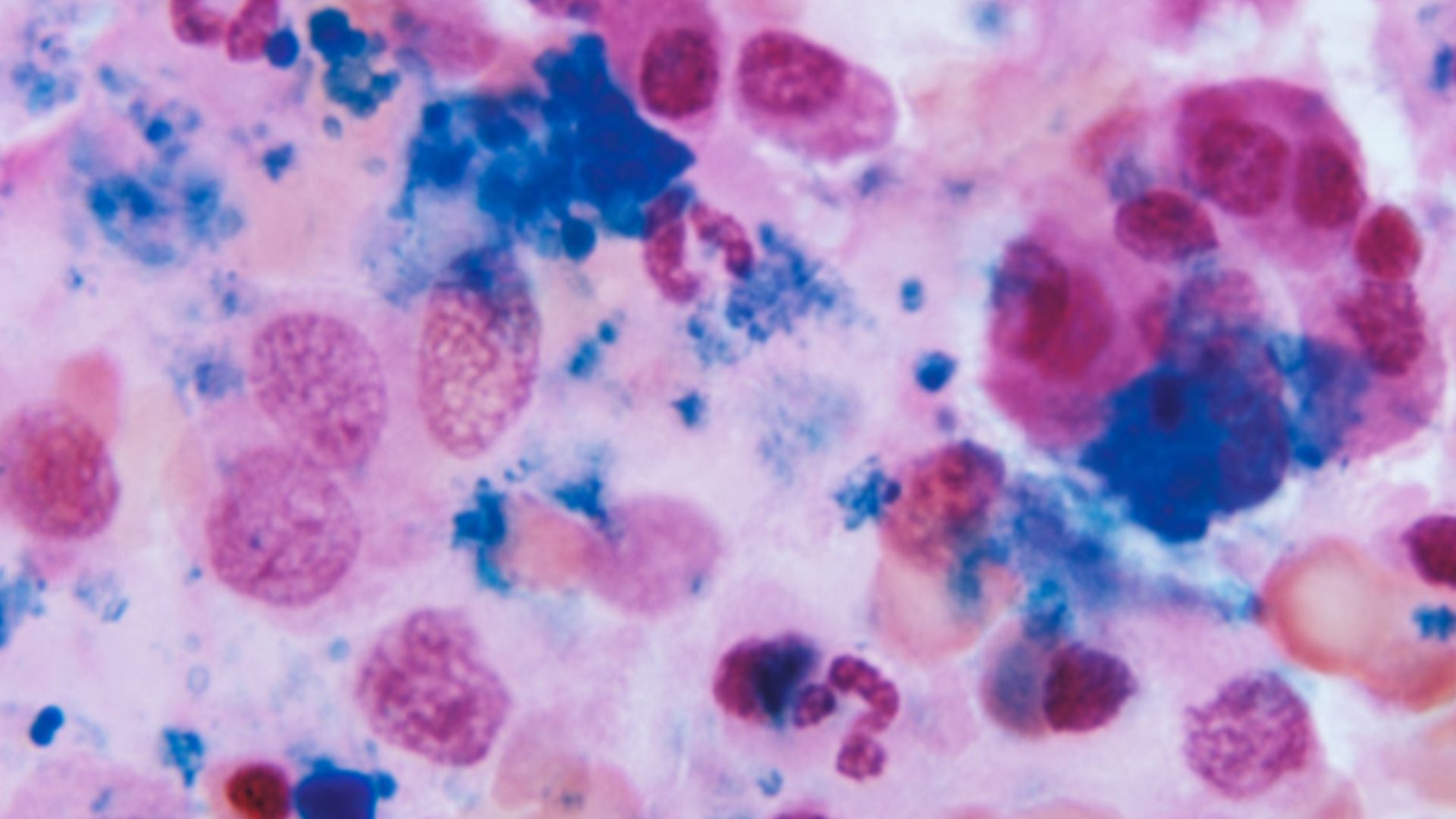 File:Section of bone marrow tissue (Prussian blue stain).jpg
