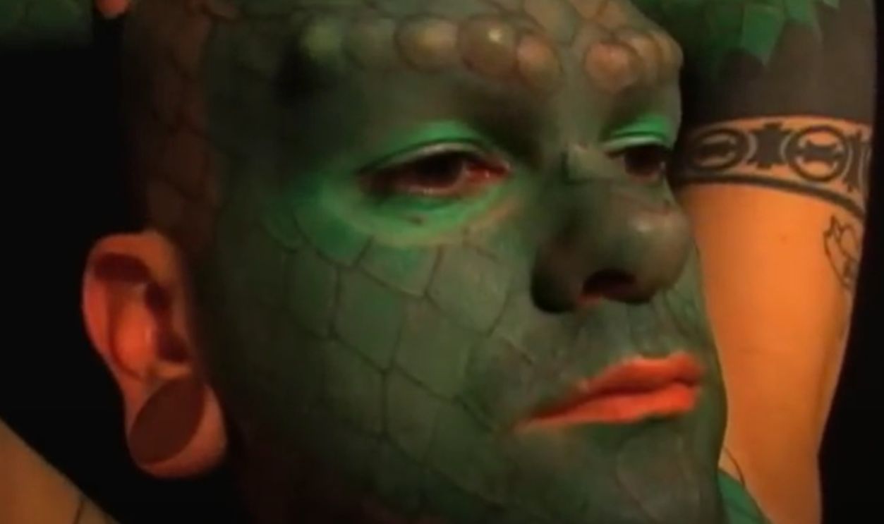 Eric the “Lizardman”